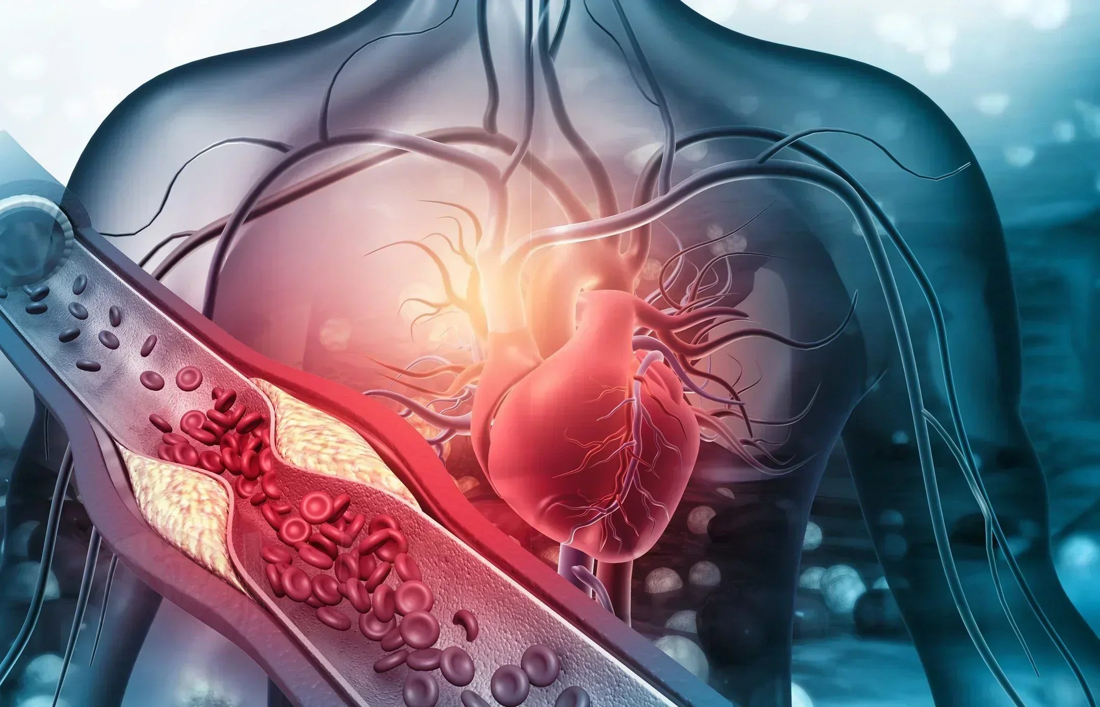 CID-10 • Capítulo IX: Doenças do aparelho circulatório (I00–I99)